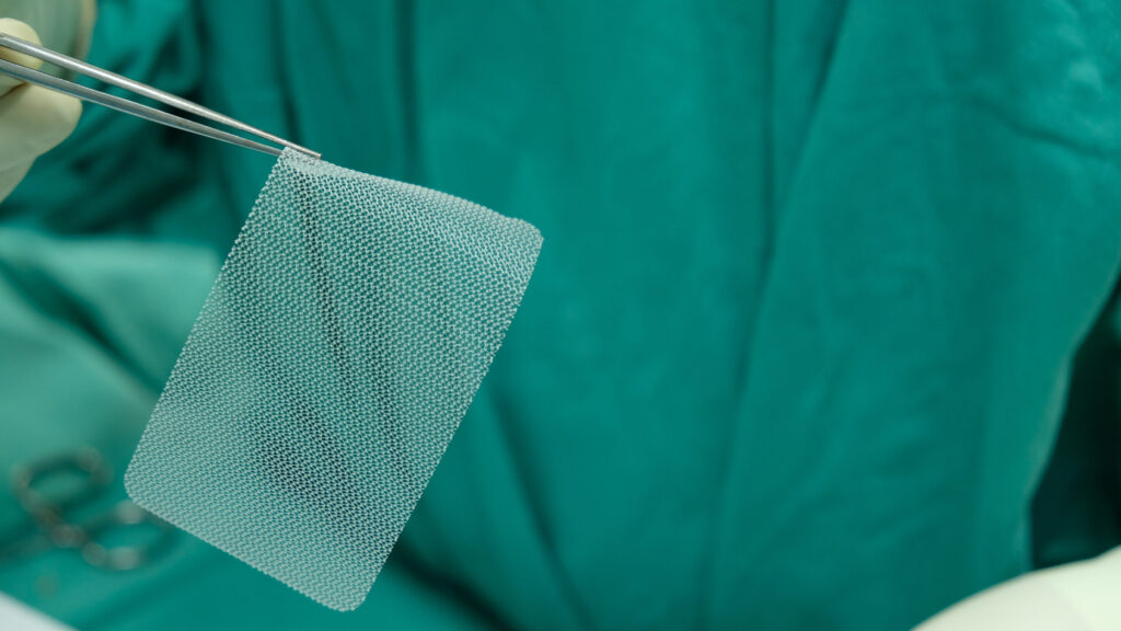 How Long Does It Take a Hernia Mesh Case to Settle?