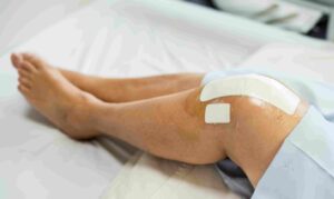 Exactech Knee Replacement Recall 