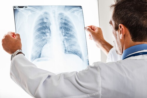 Pulmonary Embolism Diagnosis Errors