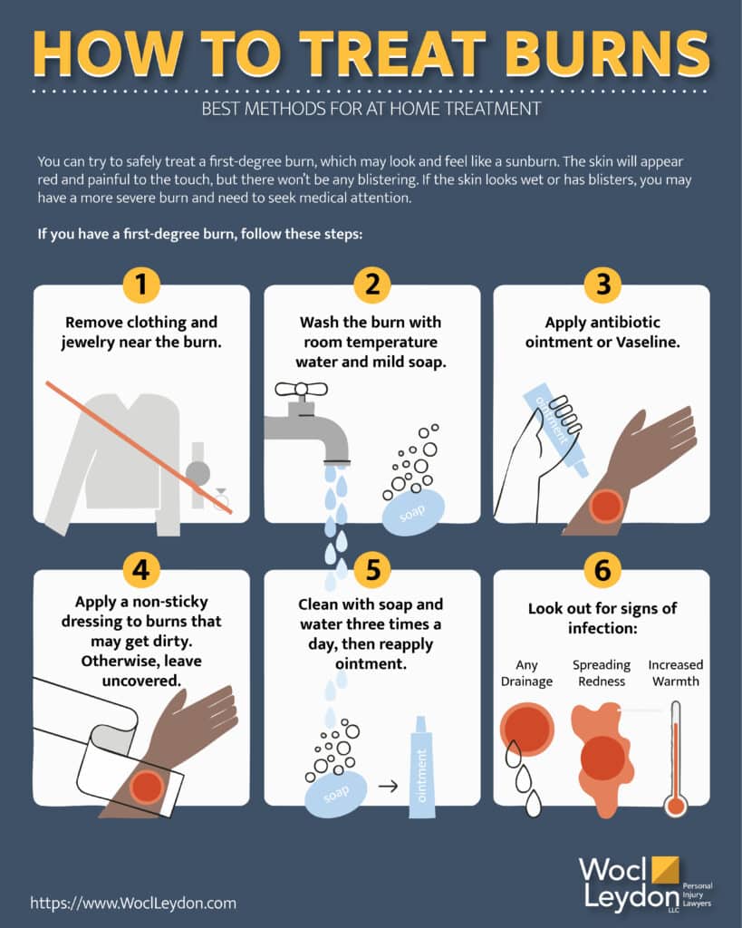 Connecticut Burn Injury Lawyer: Protecting Your Rights and Recovery